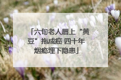 六旬老人唇上“黄豆”拖成癌 四十年烟瘾埋下隐患